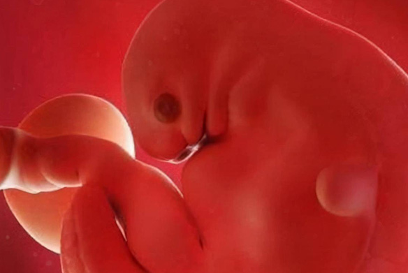 贵阳42岁助孕男孩-男生超声孕囊图_如何区分男女孕囊。